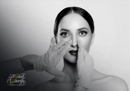 The role of the PR technique in rhinoplasty The role of the PR technique in rhinoplasty