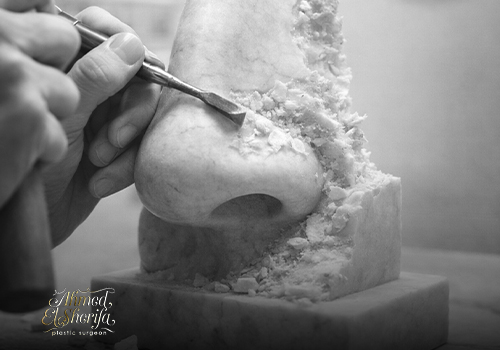 إعادة ترميم الأنف: متى تحتاج لإعادة العملية؟ وما الحل بعد فشل الجراحة الأولى؟