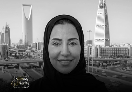 تجميل الجفون في الرياض: الأنواع، النتائج، والتكلفة بالتفصيل