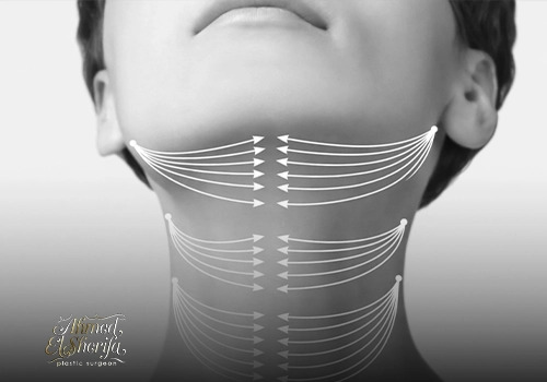 شد الرقبة بالخيوط: المميزات والعيوب