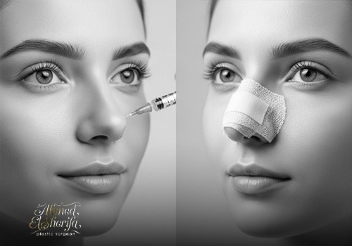 الفرق بين تجميل الأنف الجراحي وغير الجراحي في الرياض | أيهما الأنسب لك؟