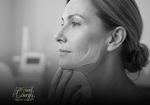 Double Chin Liposuction