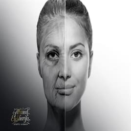 Combined Face and Neck lift- Mix Lifting