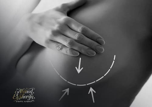breast lift breast lift