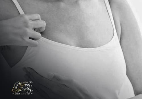Silicone implant for Breast augmentation Silicone implant for Breast augmentation