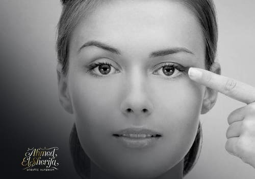 عملية تجميل العيون عملية تجميل العيون