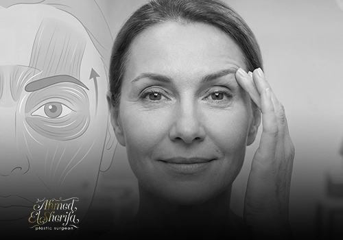 رفع الحاجب | عملية شد ورفع الحواجب بنتائج طبيعية