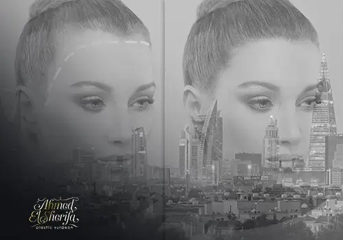 عملية تصغير الجبهة في الرياض عملية تصغير الجبهة في الرياض