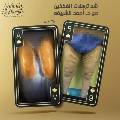 د. أحمد الشريفه