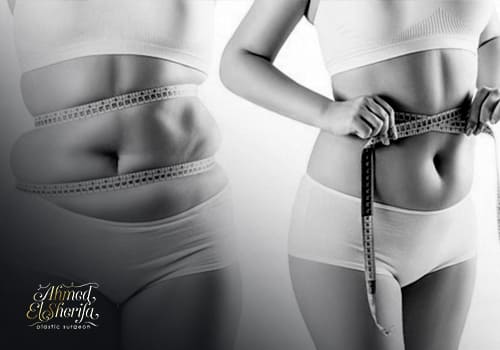 Difference between liposuction and liposculpture Difference between liposuction and liposculpture