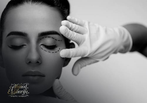 أنواع-عمليات-تجميل-العيون أنواع-عمليات-تجميل-العيون