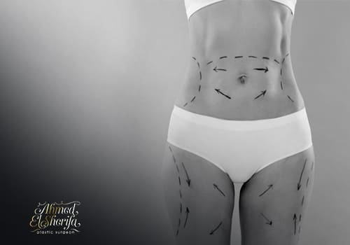 mummy makeover mummy makeover