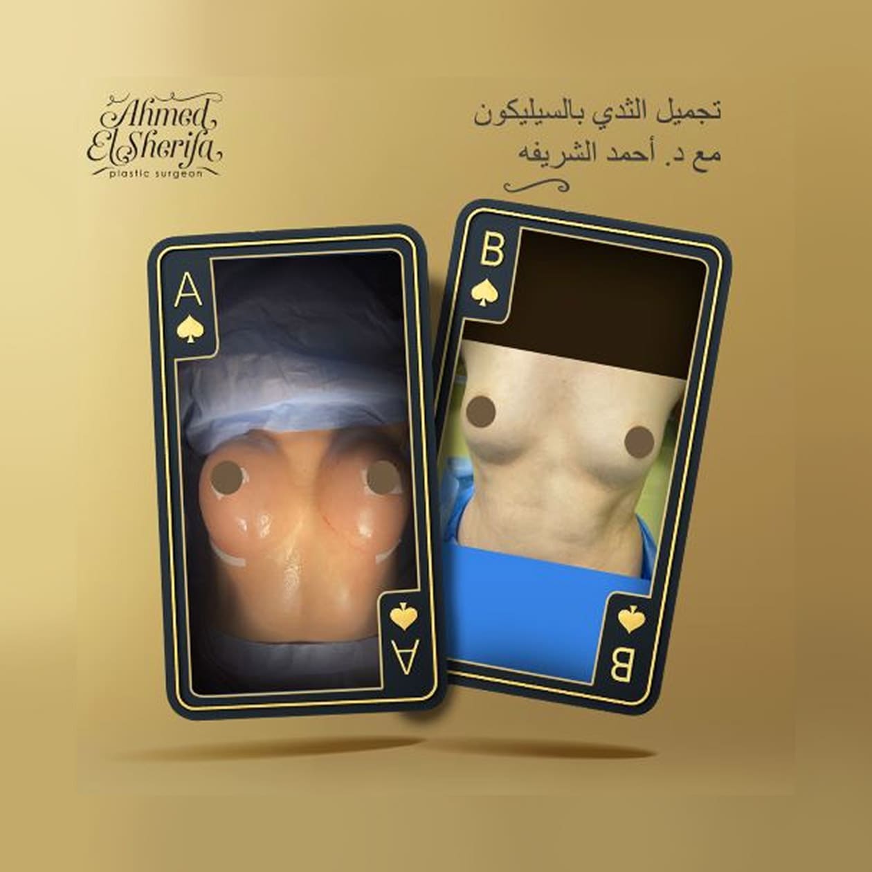 تجميل الثدي بالسيليكون تجميل الثدي بالسيليكون